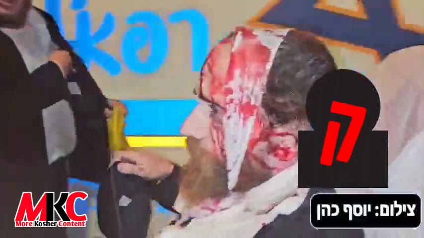 נאר פאר שטארקע הערצער: ווידעא פון צעבלוטיגטע מוחים וועלכע ווערן אפגעפירט דורך הצלה אין שפיטאל נאכן כאפן ביטע…
